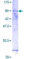 ab158605 on a 12.5% SDS-PAGE stained with Coomassie Blue.