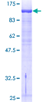 ab160551 on a 12.5% SDS-PAGE stained with Coomassie Blue.