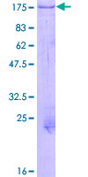 ab160552 on a 12.5% SDS-PAGE stained with Coomassie Blue.