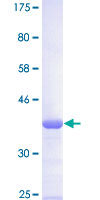 ab160553 on a 12.5% SDS-PAGE stained with Coomassie Blue.