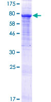 ab164511 on a 12.5% SDS-PAGE stained with Coomassie Blue.