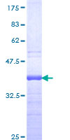 ab158606 on a 12.5% SDS-PAGE stained with Coomassie Blue.