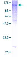 ab158607 on a 12.5% SDS-PAGE stained with Coomassie Blue.
