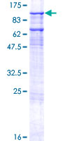 ab160432 on a 12.5% SDS-PAGE stained with Coomassie Blue.