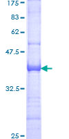 ab160433 on a 12.5% SDS-PAGE stained with Coomassie Blue.