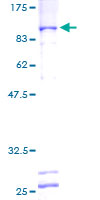 ab160429 on a 12.5% SDS-PAGE stained with Coomassie Blue.