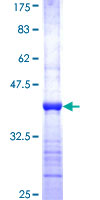 ab160430 on a 12.5% SDS-PAGE stained with Coomassie Blue.