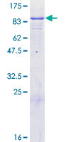 ab160549 on a 12.5% SDS-PAGE stained with Coomassie Blue.