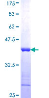 ab162812 on a 12.5% SDS-PAGE stained with Coomassie Blue.