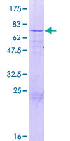 ab161915 on a 12.5% SDS-PAGE stained with Coomassie Blue.