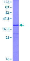 ab162579 on a 12.5% SDS-PAGE stained with Coomassie Blue.