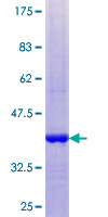 ab158611 on a 12.5% SDS-PAGE stained with Coomassie Blue.
