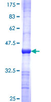 ab158608 on a 12.5% SDS-PAGE stained with Coomassie Blue.