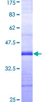 ab158612 on a 12.5% SDS-PAGE stained with Coomassie Blue.