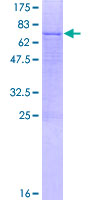 ab166139 on a 12.5% SDS-PAGE stained with Coomassie Blue.