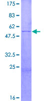 ab158624 on a 12.5% SDS-PAGE stained with Coomassie Blue.