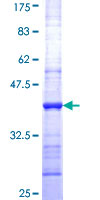 ab158625 on a 12.5% SDS-PAGE stained with Coomassie Blue.