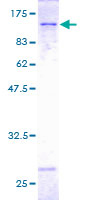 ab158080 on a 12.5% SDS-PAGE stained with Coomassie Blue.