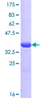ab161672 on a 12.5% SDS-PAGE stained with Coomassie Blue.