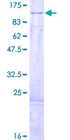 ab158631 on a 12.5% SDS-PAGE stained with Coomassie Blue.