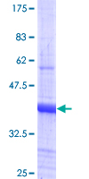 ab153410 on a 12.5% SDS-PAGE stained with Coomassie Blue.