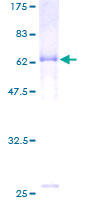 ab158200 on a 12.5% SDS-PAGE stained with Coomassie Blue.