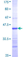 ab161646 on a 12.5% SDS-PAGE stained with Coomassie Blue.
