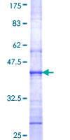 ab153547 on a 12.5% SDS-PAGE stained with Coomassie Blue.