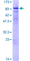 ab162044 on a 12.5% SDS-PAGE stained with Coomassie Blue.