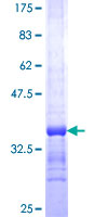 ab158644 on a 12.5% SDS-PAGE stained with Coomassie Blue.