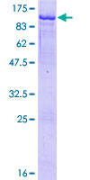 ab161145 on a 12.5% SDS-PAGE stained with Coomassie Blue.