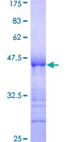 ab163793 on a 12.5% SDS-PAGE stained with Coomassie Blue.