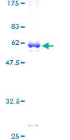 ab158645 on a 12.5% SDS-PAGE stained with Coomassie Blue.