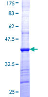 ab158646 on a 12.5% SDS-PAGE stained with Coomassie Blue.