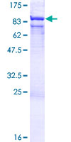 ab160166 on a 12.5% SDS-PAGE stained with Coomassie Blue.