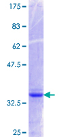 12.5% SDS-PAGE showing ab117018 at approximately 35.20 kDa. Stained with Coomassie Blue.