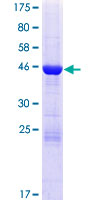ab162395 on a 12.5% SDS-PAGE stained with Coomassie Blue.