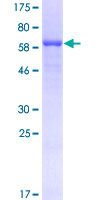 ab161223 on a 12.5% SDS-PAGE stained with Coomassie Blue.