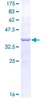 ab161224 on a 12.5% SDS-PAGE stained with Coomassie Blue.