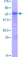 ab161284 on a 12.5% SDS-PAGE stained with Coomassie Blue.