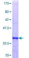 ab161285 on a 12.5% SDS-PAGE stained with Coomassie Blue.