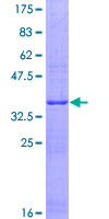 ab162636 on a 12.5% SDS-PAGE stained with Coomassie Blue.