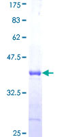 ab162453 on a 12.5% SDS-PAGE stained with Coomassie Blue.