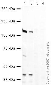 All lanes : Anti-HEF1 antibody ( ab37161 ) at 1/250 dilution Lane 1 : HeLa (Human epithelial carcinoma cell line) Whole Cell Lysate Lane 2 : Jurkat (Human T cell lymphoblast-like cell line) Whole Cell Lysate ( ab7899 ) Lane 3 : HeLa (Human epithelial carcinoma cell line) Whole Cell Lysate with Human HEF1 peptide (ab39117) at 1 µg/ml Lane 4 : Jurkat (Human T cell lymphoblast-like cell line) Whole Cell Lysate ( ab7899 ) with Human HEF1 peptide (ab39117) at 1 µg/ml Lysates/proteins at 10 µg per lane. Secondary IRDye 680 Conjugated Goat Anti-Rabbit IgG (H+L) at 1/10000 dilution Performed under reducing conditions. Predicted band size : 110 kDa Observed band size : 120 kDa ( why is the actual band size different from the predicted? ) Additional bands at : 40 kDa. We are unsure as to the identity of these extra bands.