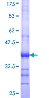 ab159513 on a 12.5% SDS-PAGE stained with Coomassie Blue.