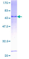 ab162543 on a 12.5% SDS-PAGE stained with Coomassie Blue.