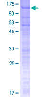 ab163085 on a 12.5% SDS-PAGE stained with Coomassie Blue.