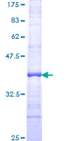 ab158637 on a 12.5% SDS-PAGE stained with Coomassie Blue.