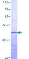 ab158639 on a 12.5% SDS-PAGE stained with Coomassie Blue.