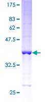 ab158640 on a 12.5% SDS-PAGE stained with Coomassie Blue.